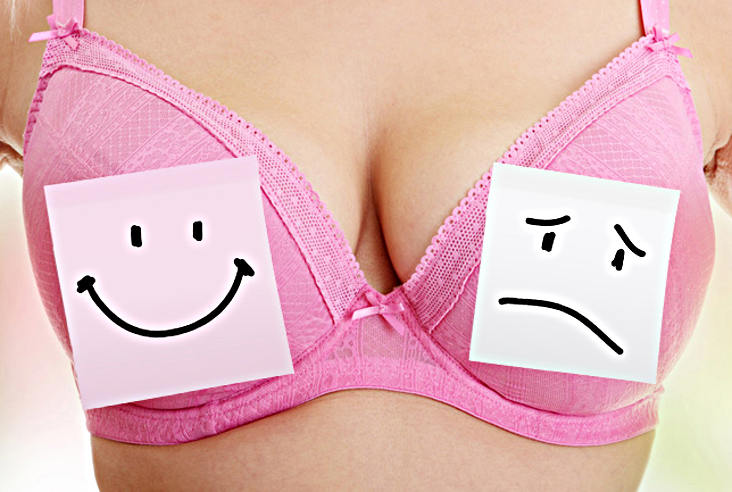 Операции по коррекции ассиметрии груди у женщин