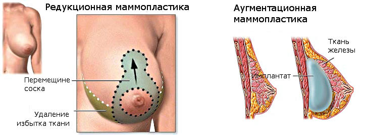 Клиника по маммопластике в Москве