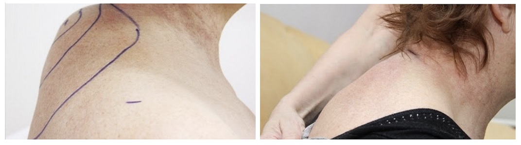 Фото до и после операции у пластического хирурга Круглика Сергея Викторовича