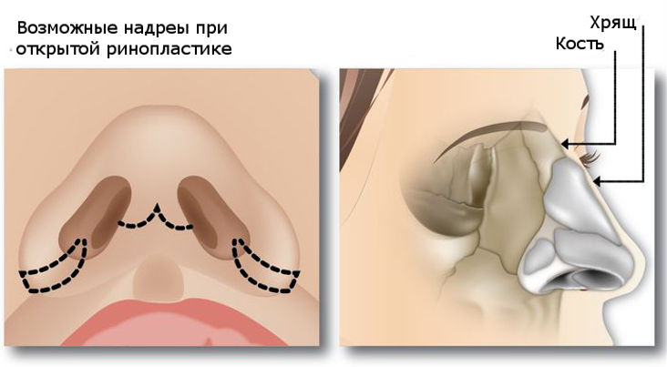 Клиника где делают операцию по пластике носа в Москве отзывы и цены