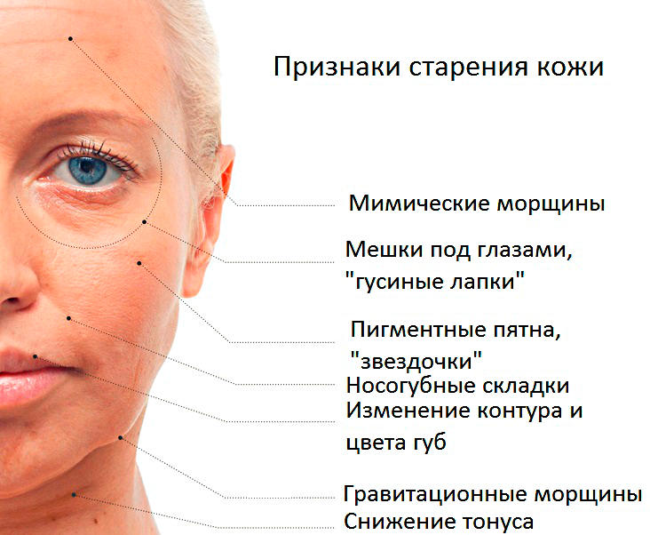 Причины и виды старения кожи лица у женщин